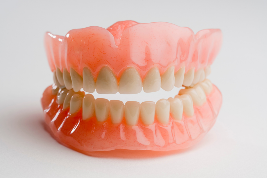 There are some cases, where implant is not an option, this can be because of a medical or physiological reason. In such cases, BPS dentures can be an option for you.